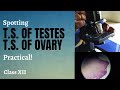 Spotting : T. S. OF TESTIS & T. S. OF OVARY | Biology practical | Class XII