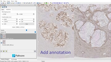 Comparing staining on multiple IHC slides