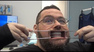 FINALLY Getting My Teeth Fixed!  Getting FULL Dental Implants by G4byGolpa!