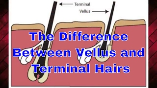 The Difference Between Vellus and Terminal Hairs | #TheBeardnecessities | Ep 33 screenshot 1