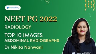 Top 10 Images | Abdominal Radiographs | NEET PG 2022 | Dr Nikita Nanwani