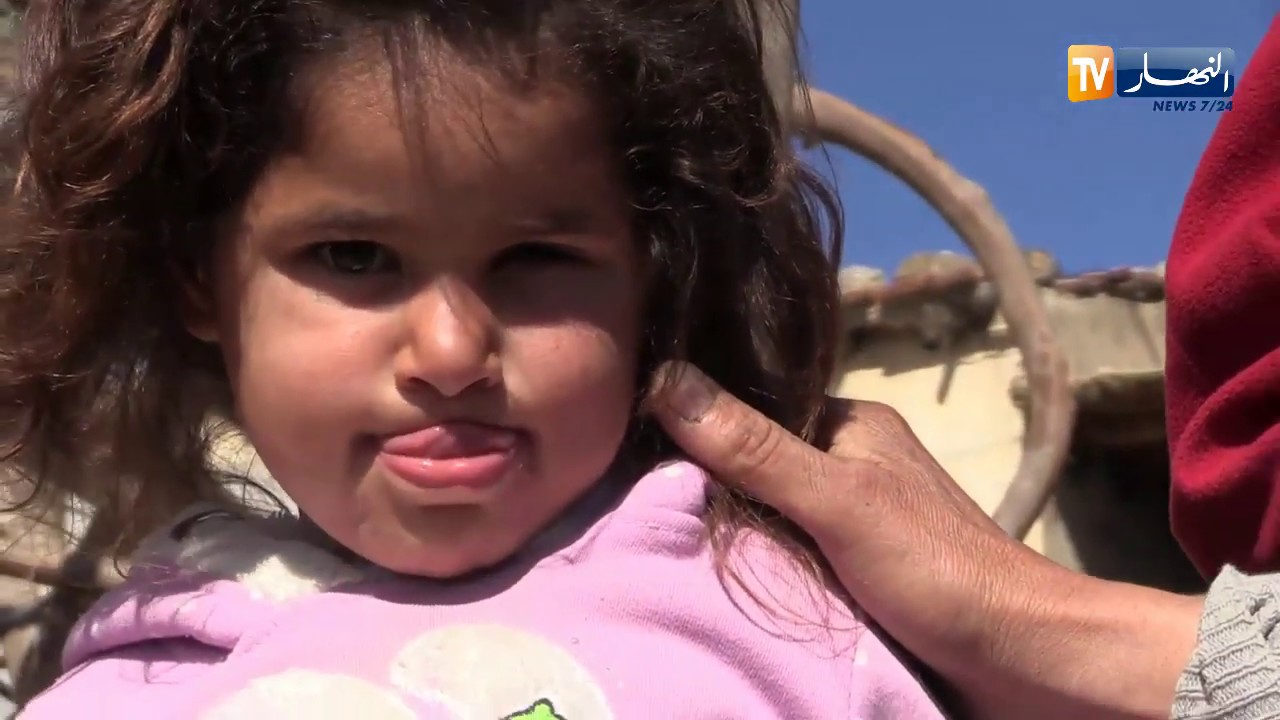إبنته فقدت عينها وبقية أطفالٍه يعيشون تحت خط  الفقر..   دوار سيدي ميسوم تيسمسيلت