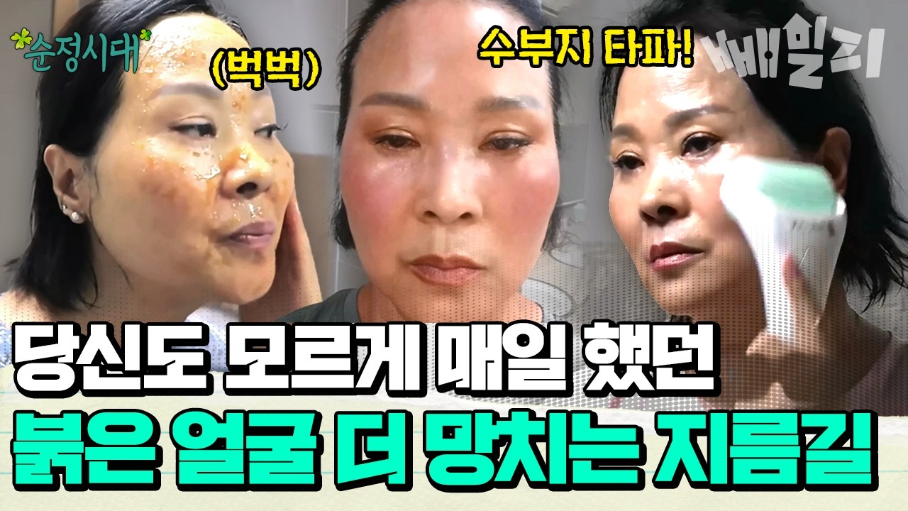 불타는 고구마 홍조 피부, '이것' 하면 다 망가진다! 피부과 의사도 기겁한 최악의 스킨케어 | #순정시대 39회