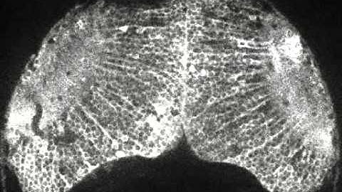 Real-time visualization of neuronal activity in the zebrafish brain (脳神経活動の可視化)