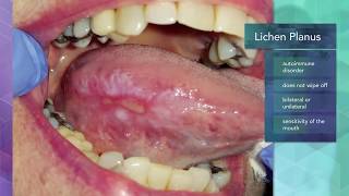 Diagnosing Oral and Maxillofacial Diseases/Pathology screenshot 2