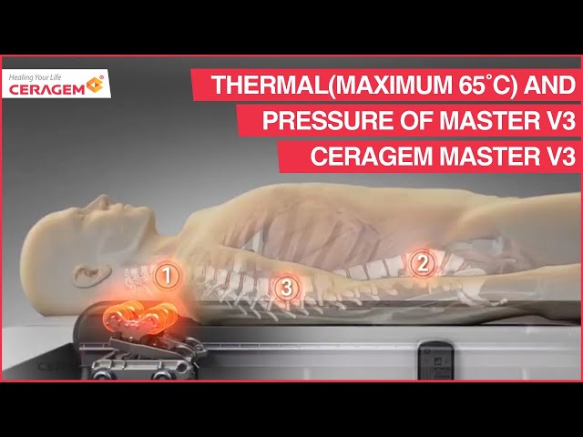 Thermal(maximum 65˚C) and pressure of Master V3 | Ceragem Master V3 | Ceragem India class=