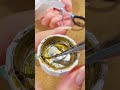 子宮全摘出したら、どうなるの？【後遺症編】