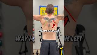 He Has SHOULDER PAIN For Months UNTIL…