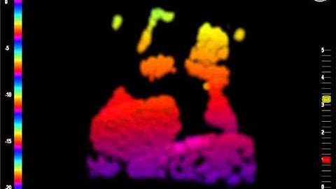 Breakwater Construction Diver Support - ACCROPODE™ 4