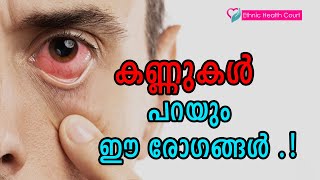 കണ്ണ് നോക്കി രോഗങ്ങൾ തിരിച്ചറിയാം | Eye disease | Ethnic Health Court screenshot 4