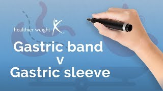 Gastric band vs Gastric sleeve