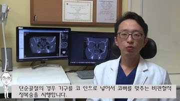 삼성드림이비인후과 강남점 코뼈골절