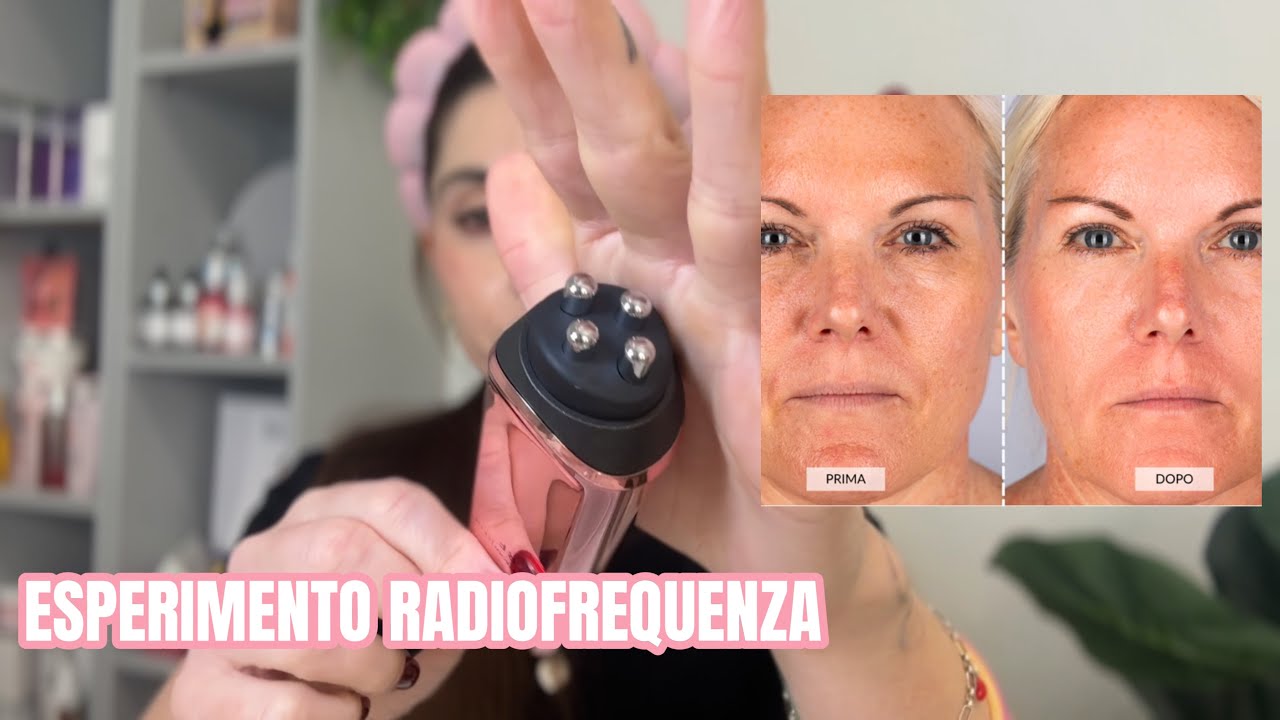 RADIOFREQUENZA E MICRONEEDLING || CurrentBody Pt. I