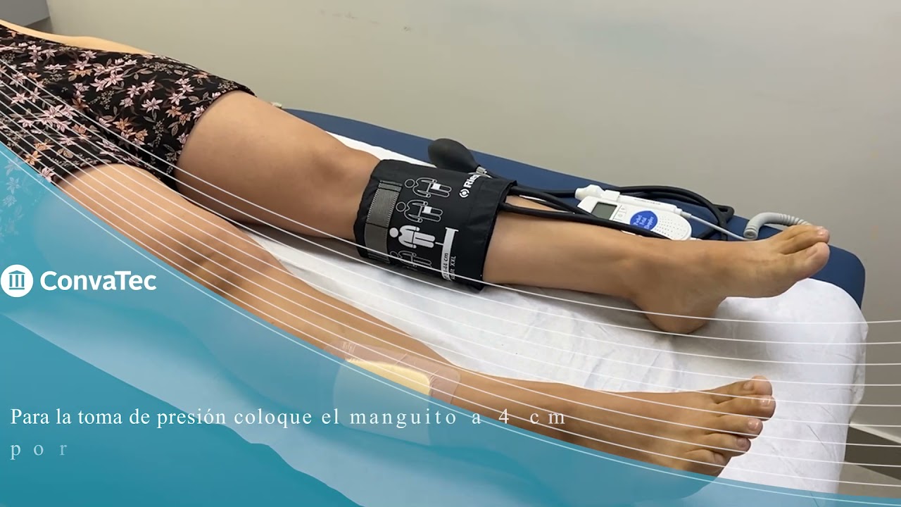 Cápsula Educativa: Indice Tobillo Brazo (ITB)