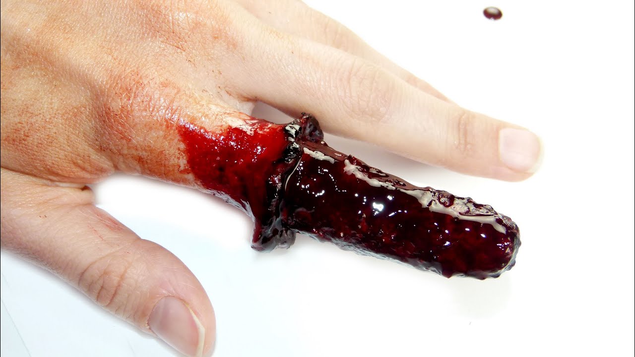 skin peeled off finger