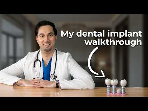 Dental Implant Procedure Step-by-Step