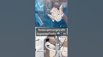 Augmented Reality in Revision Spine Surgery 🥽🤯🤓📚✅