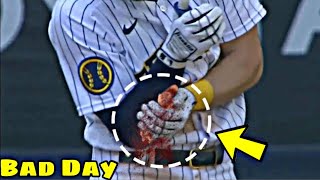 MLB | Bad Day (Hit By Pitch)