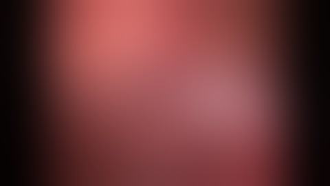 laparoscopic right nephrectomy in 10 steps  by prof soliman Elshakhs hs