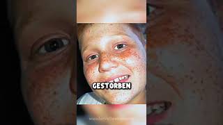 Parents hear their son's heartbeat again at his wedding! 💔🫀