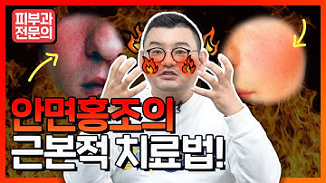 안면홍조?없애는법! 더이상 놀림받지 마세요! (근본적치료법)