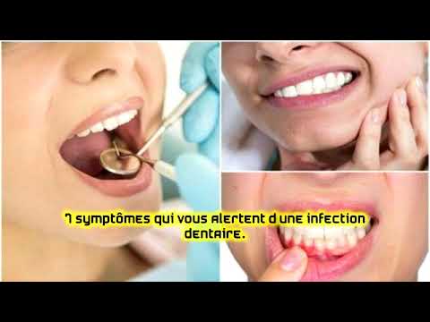 Vidéo: Les Symptômes D'une Infection Dentaire Se Propageant Au Corps