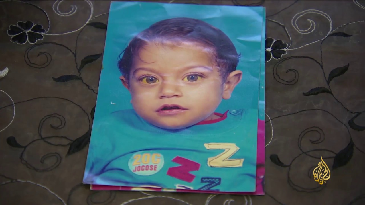 هذا الصباح- إجراء أول عملية لزراعة الكبد في قطر