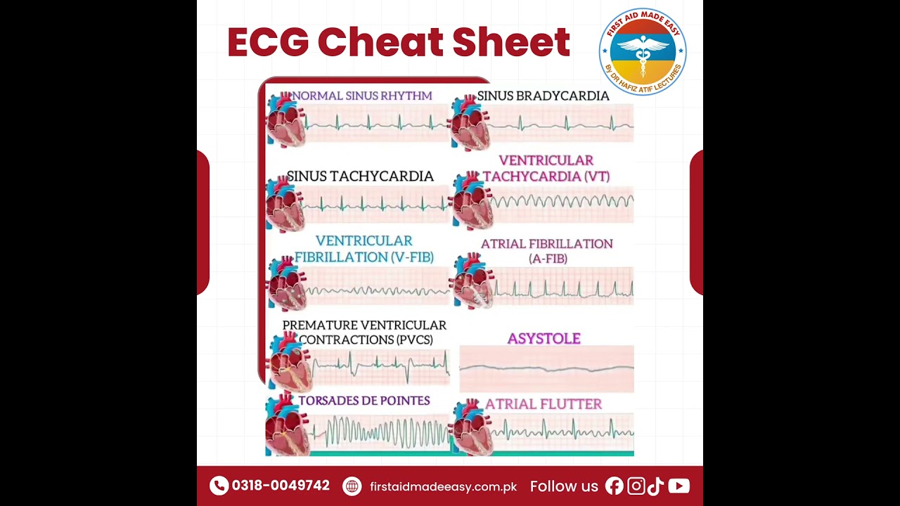 ECG MADE EASY BY FIRST AID MADE EASY PLATFORM | First Aid Made Easy Platform #drhafizatif