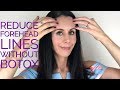 Reduce Forehead Lines Without Botox