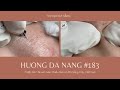 #183 | Huong Da Nang