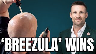 Why The New Topical Hair Loss Drug 'Breezula' Has The Most Promise Since Finasteride!
