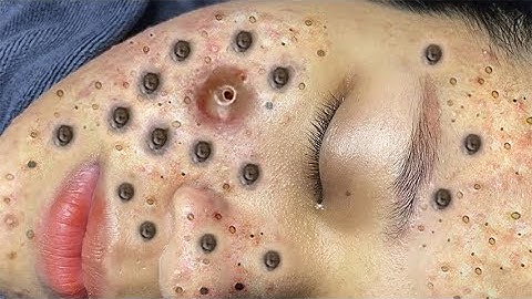 When you reach the end of your rope, tie a knot in it and hang on #215