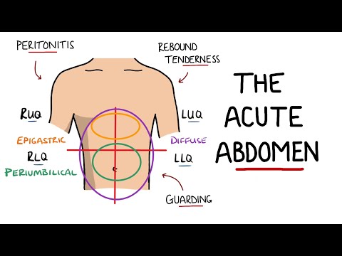 Acute Abdomen - A Guide to Acute Abdominal Pain