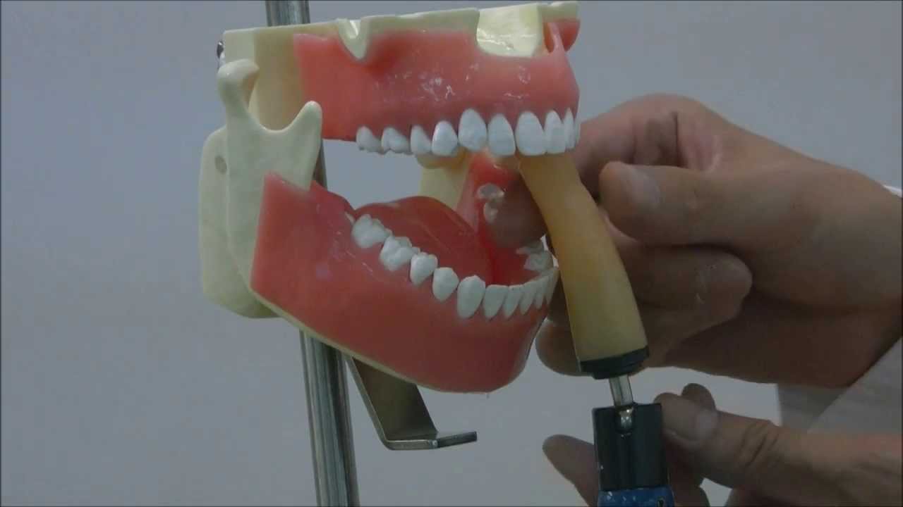 NISSN XRay Simulator for mastering Dental Radiography [Tripod Xray Manikin] YouTube