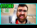 Uncle Jay Gets Stitches!