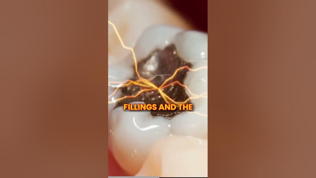 Exploding teeth. Shocking truth - YouTube