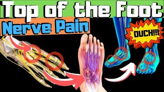 Sharp, Burning, Tingling Top of Foot Pain? [FIX Your Nerve Pain!]