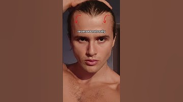 greatest post-puberty natural looksmaxxing transformation