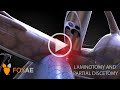 Laminotomy and Partial Discectomy | Legal Animation | Surgery Demonstration