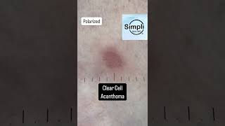 Come See What Your Dermatologist Sees