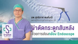 การผ่าตัดกระดูกสันหลังด้วยการส่องกล้อง Endoscope (Endoscopic spine surgery)
