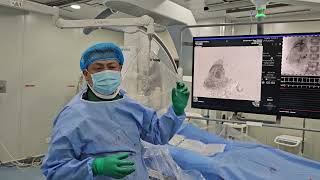 U thận trên bn trẻ tuổi.  Bs Dương 0399 777 888 