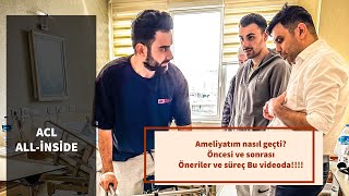 Op. Dr. Emre Kaya   ACL ALL-İNSİDE Ön Çapraz Bağ Ameliyatı. Resimi