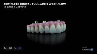 Advanced Full-Arch Implant Workflow with Nexus iOS | IMPrESS Perio