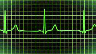 Heartbeat 32 Weeks