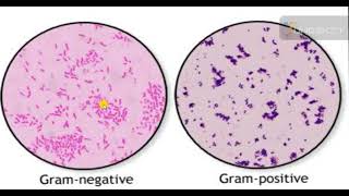 Gram staining| Gram Staining Procedure Animation Microbiology - Principle, Procedure, Interpretation