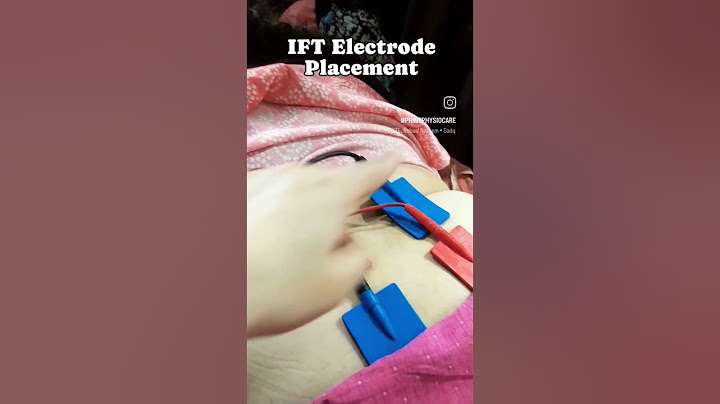 Interferential Therapy for back || IFT Electrode Placement #physiotherapy #electrotherapy #shorts