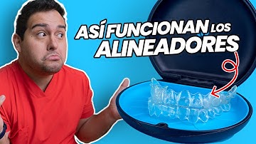 ¿COMO FUNCIONA LA ORTODONCIA INVISIBLE INVISALIGN? ¡ASI MUEVEN LOS DIENTES LOS ALINEADORES DENTALES!