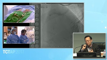 [TCTAP 2017] CTO Live - Live Case Session III