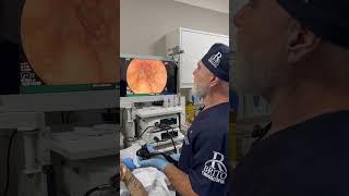 Refluxo Tem Solução Diagnóstico Preciso Para Um Tratamento Eficaz